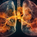 The Interplay Between Obesity and Lung Cancer